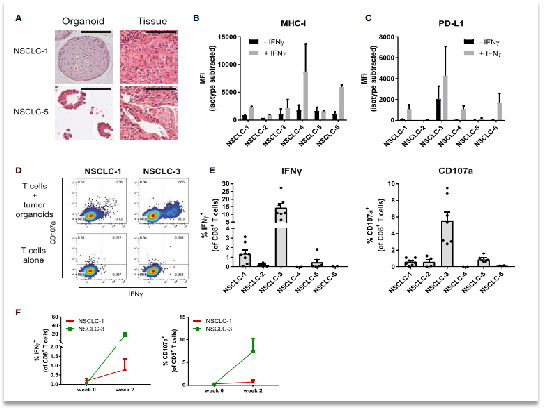 免疫共培养之——类器官