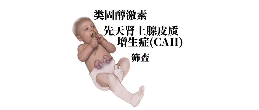 类固醇激素和先天肾上腺皮质增生症(CAH)的筛查