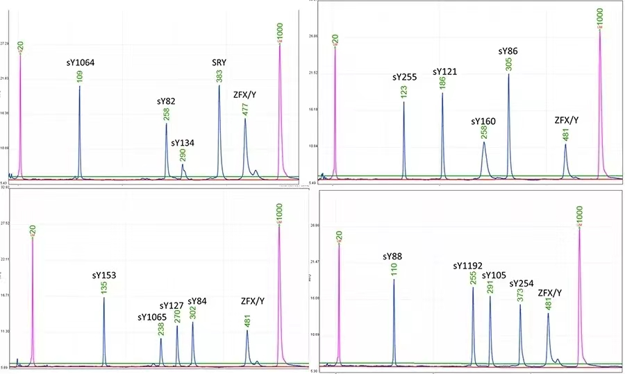 注意！也许用很简单的方法可以有效进行临床诊断