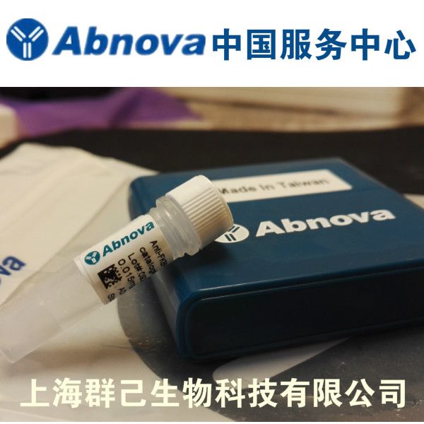 ROPN1B antibody
