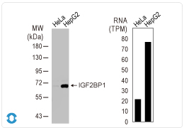 IGF2BP1 antibody (GTX134816)