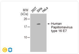 Human Papilloma Virus type 16 E7 antibody (GTX133411)