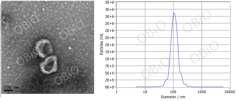 外泌体到底有多神秘？看了就知道答案了！