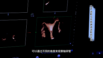 仿佛打桩机在子宫里施工？三招化解「最疼」妇科检查之痛！