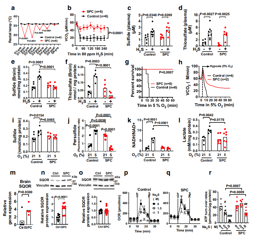 硫化物的分解代谢可改善缺氧性脑损伤