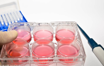 细胞培养关键操作步骤关注