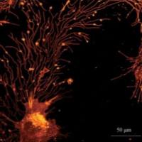 迁移体电镜检测