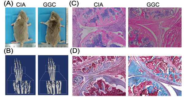 ASPS通过重编程肠道菌群和提高血清휸-Glutamylcysteine水平促进机体抗风湿（IF = 17.521 ）