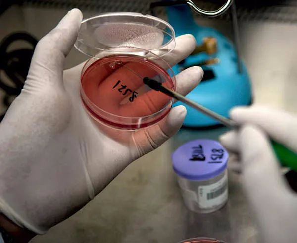 全面解析丨菌落总数检测知识汇总,新手必看~