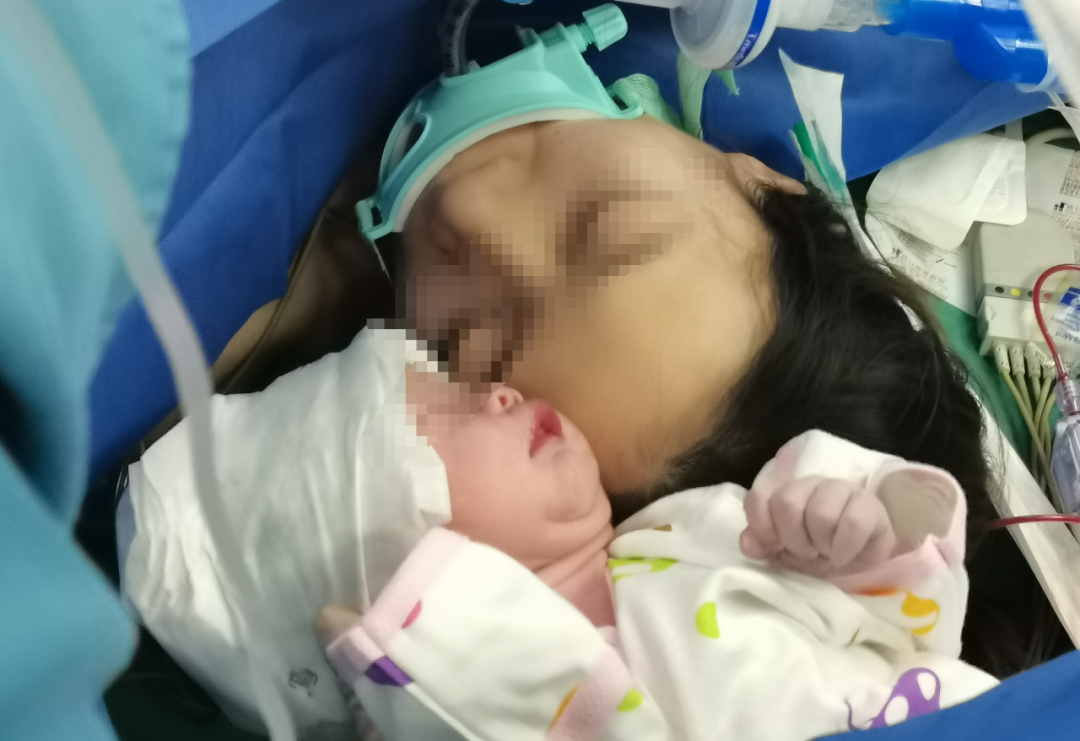 二胎孕妈完全子宫破裂，西安大兴医院多学科联合 20 分钟急速救援