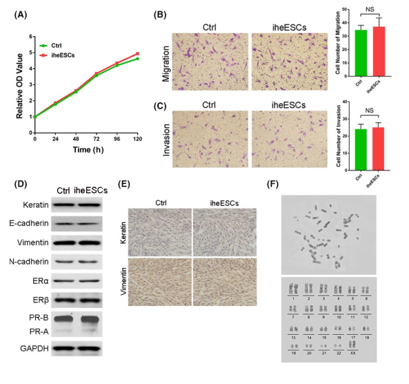 人肝癌细胞3D器官型培养模型