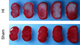 关注！缺氧缺血性脑损伤实验动物模型