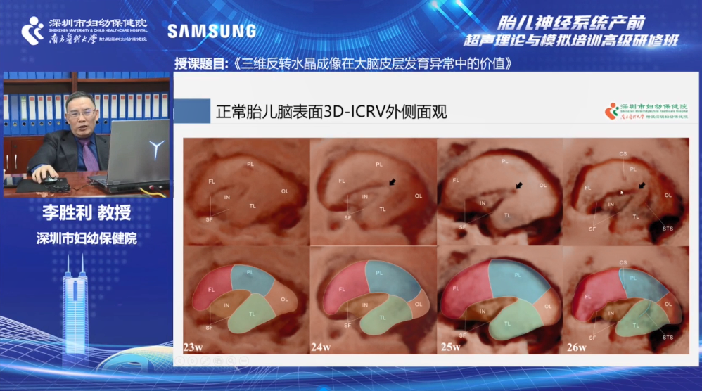 深圳市妇幼保健院重磅发布胎儿中枢神经系统超声评估新方法