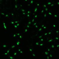 细胞周期凋亡试验