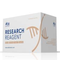 酵母蛋白提取试剂盒