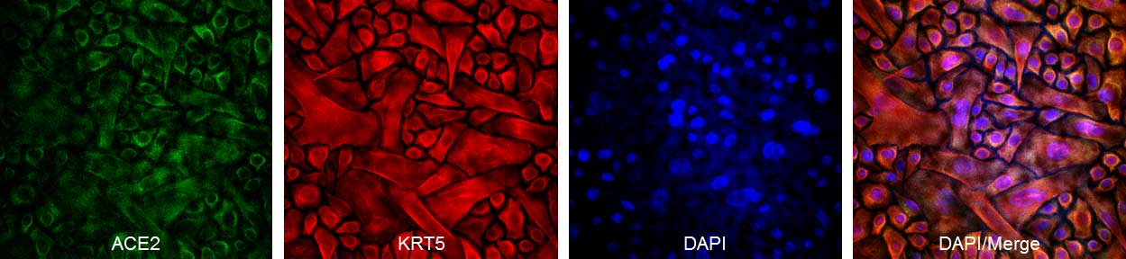 原代细胞厂家浅谈之-- Cell Applications 
