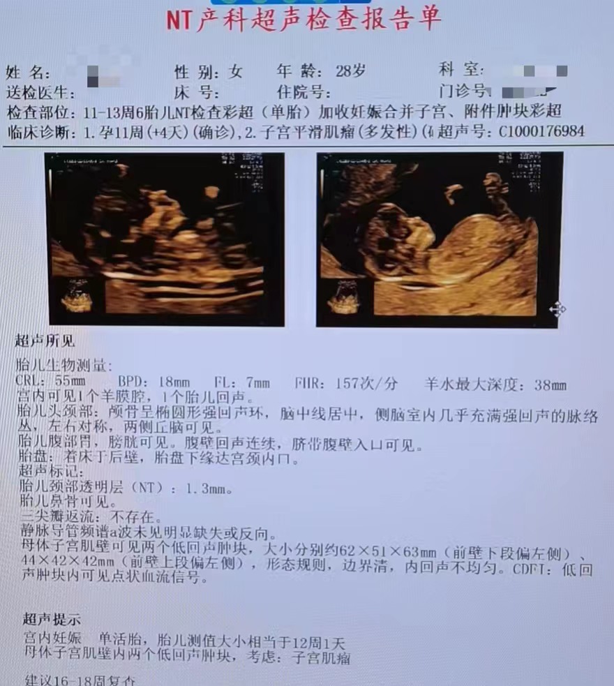 「拆弹」专家上线！妊娠合并子宫肌瘤，一场母婴保卫战正在打响...