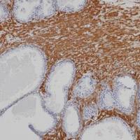 Actin (Smooth Muscle) Recombinant Mouse mAb