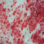 人间充质干细胞成骨诱导分化培养试剂盒