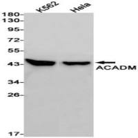ACADM (DGR33275) Rabbit mAb
