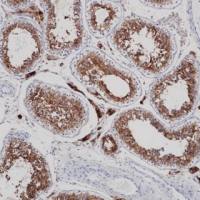 ACE2 Recombinant Rabbit mAb