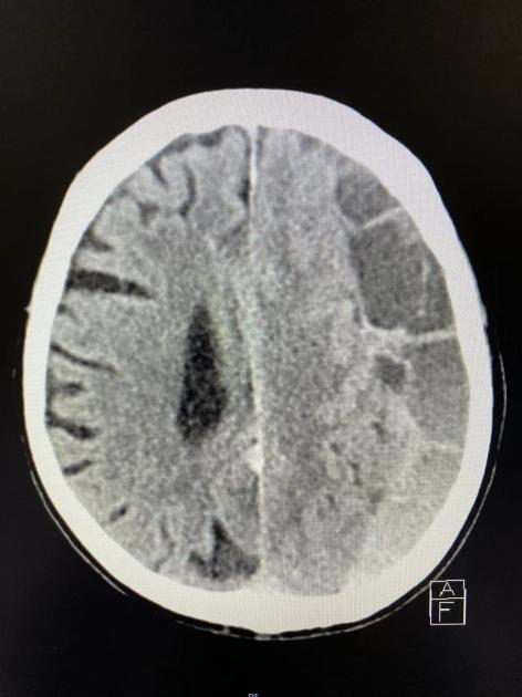 7*24 小时,全力奋战危急重症救治第一线!
