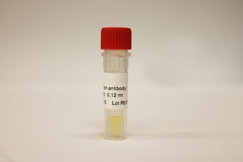 Human Chorionic Gonadotropin β (HCGβ) Antigen >99%