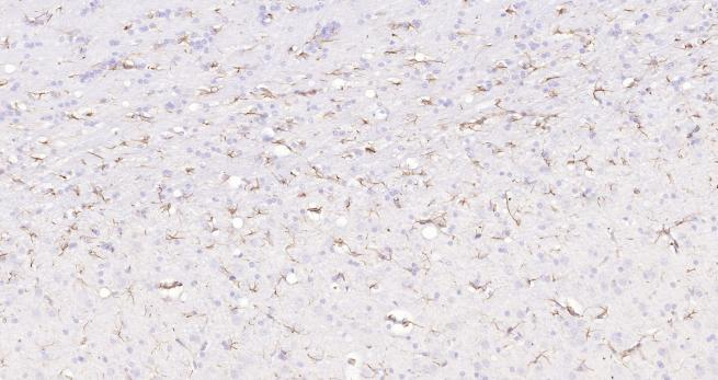 新品上市丨实验试剂一盒配齐 完美结果一次搞定