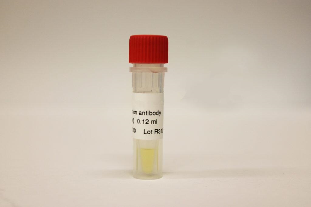 Inhibin B (INHB) Antibody