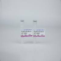 100bp DNA Ladde rMarker（100-1500bp）