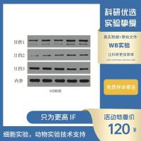 Western Blot检测/WB检测