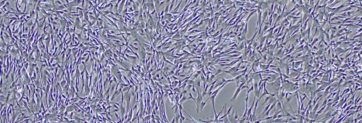 间充质干细胞成骨诱导注意事项