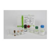 IBL-America JP27717AMYLOID BETA (1-38) (FL) AΒ,β淀粉样蛋白片段(1-38) 高敏酶免检测试剂盒,96test