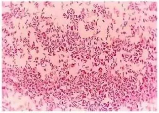 大肠菌群、粪大肠、大肠埃希氏菌检验的相关知识