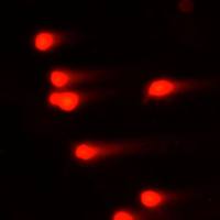 分子实验-彗星实验