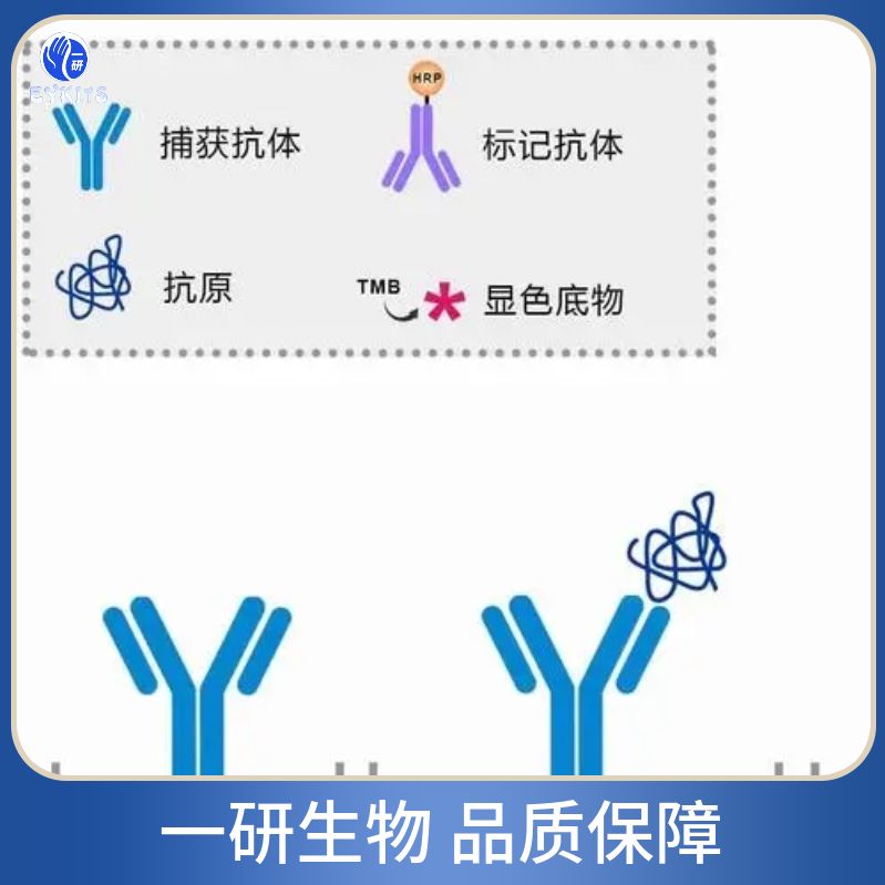 丝/苏氨酸蛋白激酶II β重组兔单克隆抗体