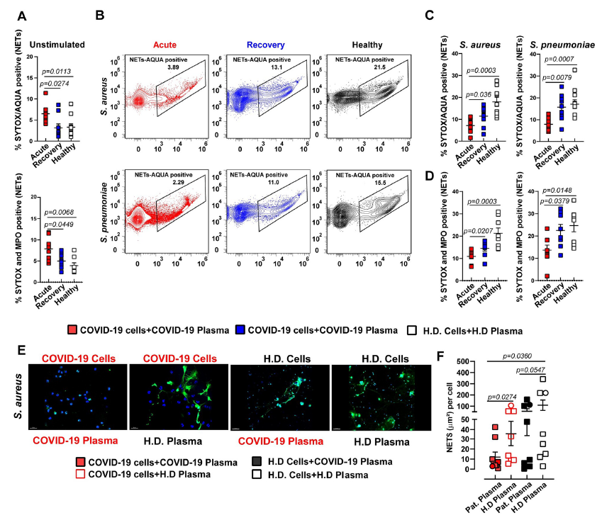 4D蛋白质组--在COVID-19中，过度炎症环境导致骨髓细胞效应反应功能失调
