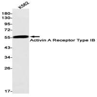 Activin A Receptor Type IB (DGR13681) Rabbit mAb