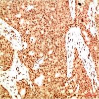 Acetyl-NF-kB p65 (Lys314/Lys315) (6D6) Mouse mAb