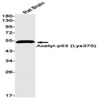 Acetyl-p53 (Lys370) Recombinant Rabbit mAb