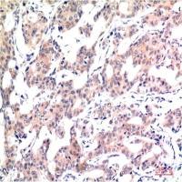 Acetyl-Histone H3 (Lys9) (10F10) Mouse mAb