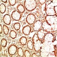 Acetyl-p53 (Lys382) (7E1) Mouse mAb
