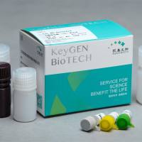 乳酸脱氢酶（LDH）测试盒