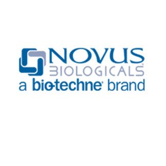 Novus单克隆和多克隆抗体、一抗、二抗、及神经生物学，细胞凋亡，肿瘤，DNA修复，干细胞标记，信号转导