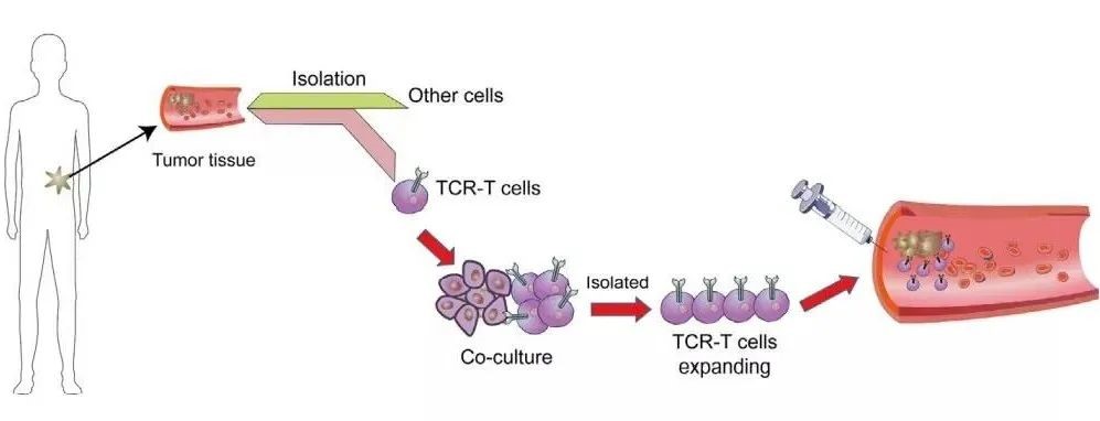TCR-T比CAR-T更适用于实体瘤治疗