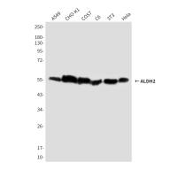 ALDH2 (8D4) Mouse mAb