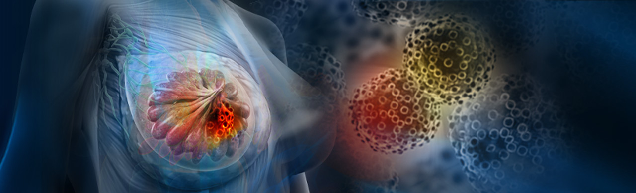 缺氧诱导表现之长链非编码RNA促使肿瘤恶化