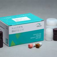 乳酸（LD）测试盒（测血清、组织等）