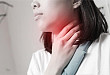 这种原因引起的咽部疼痛该如何治疗？