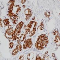 AMACR Recombinant Mouse mAb